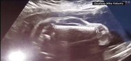 Pregnant woman's sonogram shows she's having ... a car.jpg