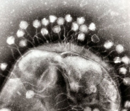 Using a virus to kill what antibiotics can’t.jpg