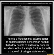 TIL there is a mutation that causes bones to become 8 times denser than normal that allow people to walk away from car accidents without a single fracture but with a trade off of being unable to swim.jpg