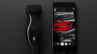 Doctor says he diagnosed his own cancer with iPhone ultrasound machine.jpg